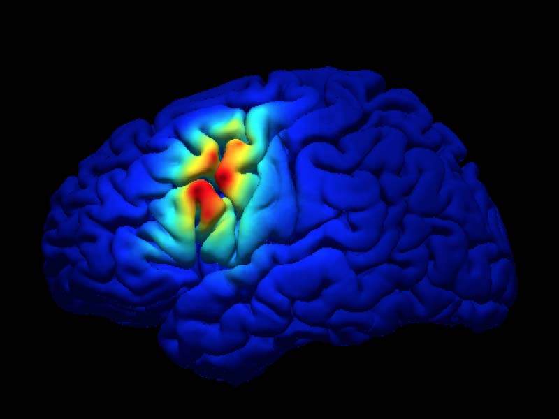 Neural Systems Lab featured photo with an activated brain.